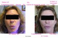 /album/photogallery/mbllips3wkrctngld-jpg/